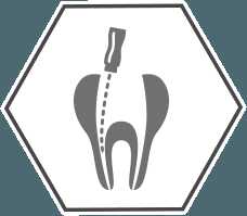 Root Canals